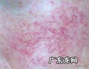 普通人做的皮肤管理靠谱吗 做皮肤管理一个周期是多长时间?