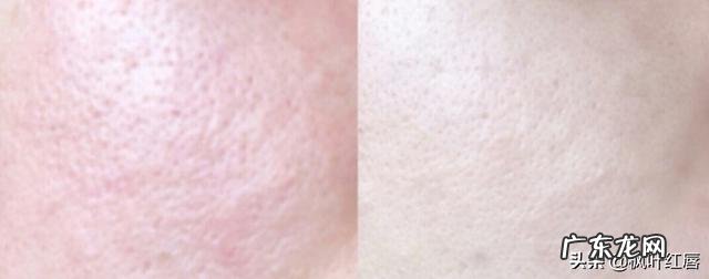 普通人做的皮肤管理靠谱吗 做皮肤管理一个周期是多长时间?