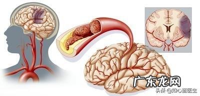 颈椎病会带来哪些问题？应该如何zhi疗？