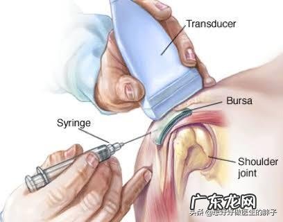 得了肩周炎,胳膊酸痛无法睡觉,该怎么办?