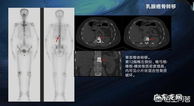 靠墙深蹲能天天做吗 每天15min的靠墙深蹲,会对机体产生什么影响呢?
