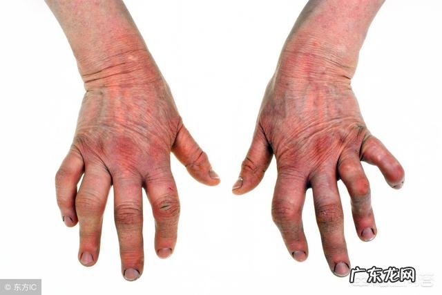 教师如何及早预防职业病?