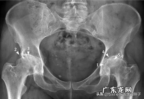 导致腰骶部疼痛的原因有哪些?