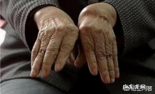 类风湿关节炎哪些食物不可以吃