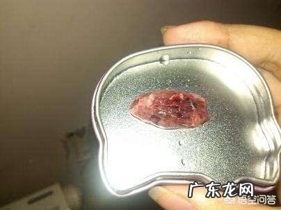 在重医做羊水穿刺检查,不交钱不能拿结果,你怎么看?
