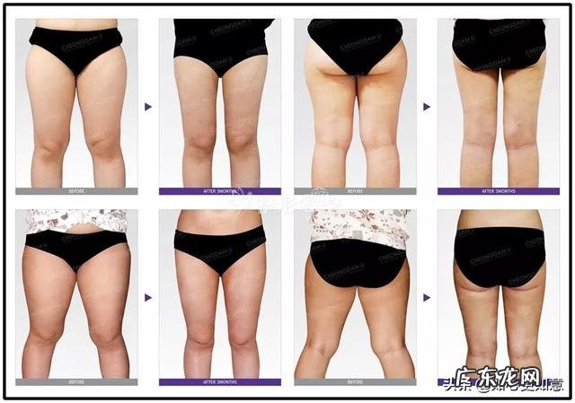 隔天进行一次快走运动可以减肥吗?有哪些健康的减肥运动?