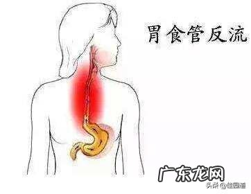 怀孕八个月烧心孕吐怎么缓解