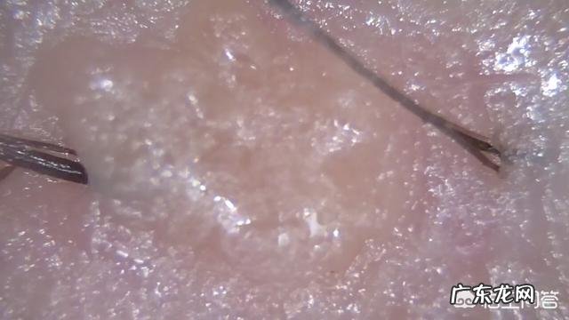 什么洗发水去油去头皮屑效果好