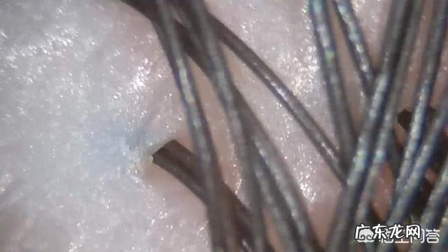 什么洗发水去油去头皮屑效果好