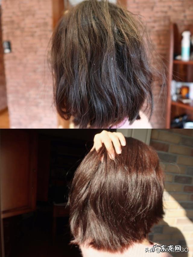 什么洗发水去油去头皮屑效果好