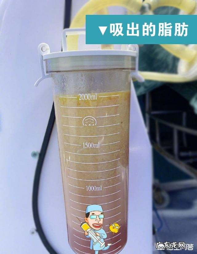 肚子大，里面是内脏脂肪多一些还是宿便多一些？