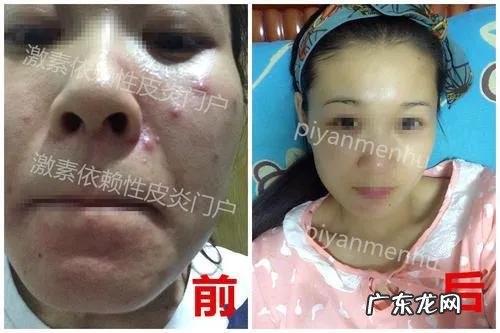 为什么有减肥药,没有增肥药嘞?