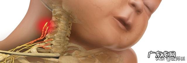 怀孕高血压会导致宝宝头大吗