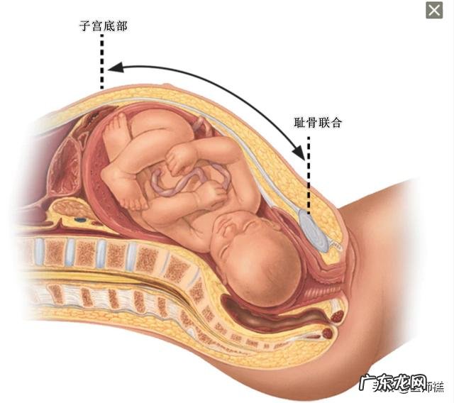 怀孕高血压会导致宝宝头大吗