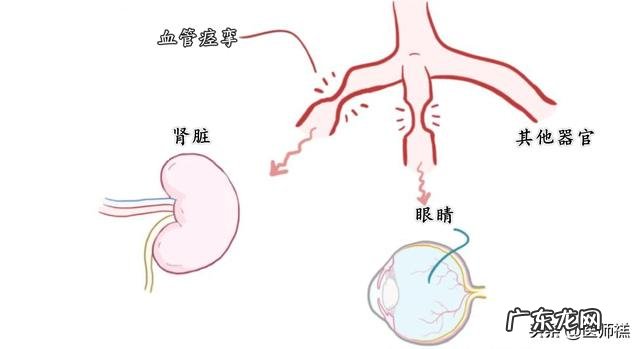 怀孕高血压会导致宝宝头大吗