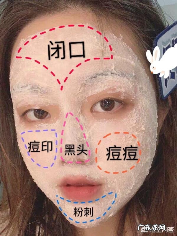 脸上长闭口,粉刺疙瘩,起皮用什么护肤品好?