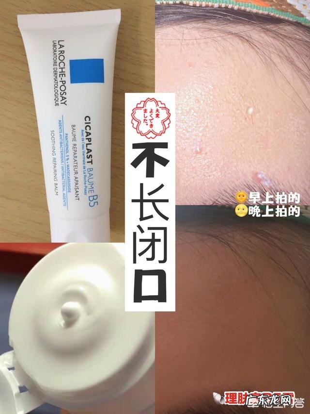 脸上长闭口,粉刺疙瘩,起皮用什么护肤品好?