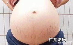 怀孕多久会长妊娠纹为什么会长妊娠纹