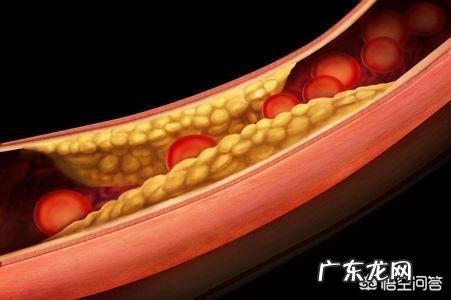 人血脂高是油摄入过多吗?