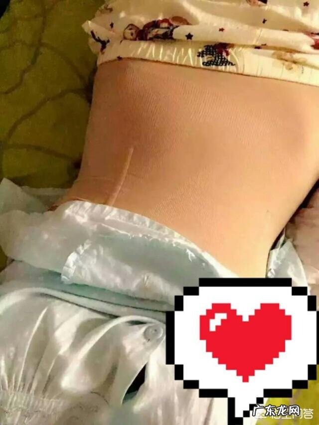 产后纯母乳喂养,在不影响术后恢复的情况下,如何减掉40斤体重