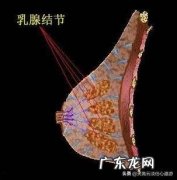 乳腺结节为何呈现多发趋势，女性应该如何预防？