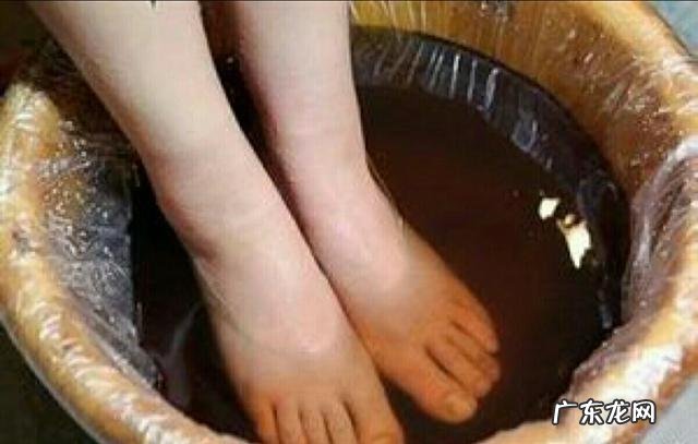 有什么好办法可以缓解静脉曲张吗?