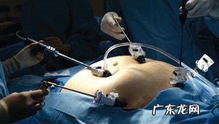 切胃减肥对身体会有多大的伤害?