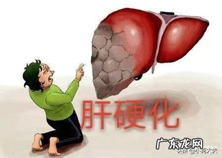 医生说:肝硬化的人,肚子上会有4种“异常”,具体指的什么?