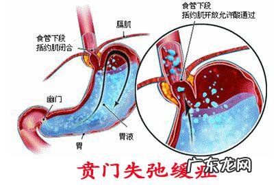 如果我有心脏病，我可以做减重手术吗？