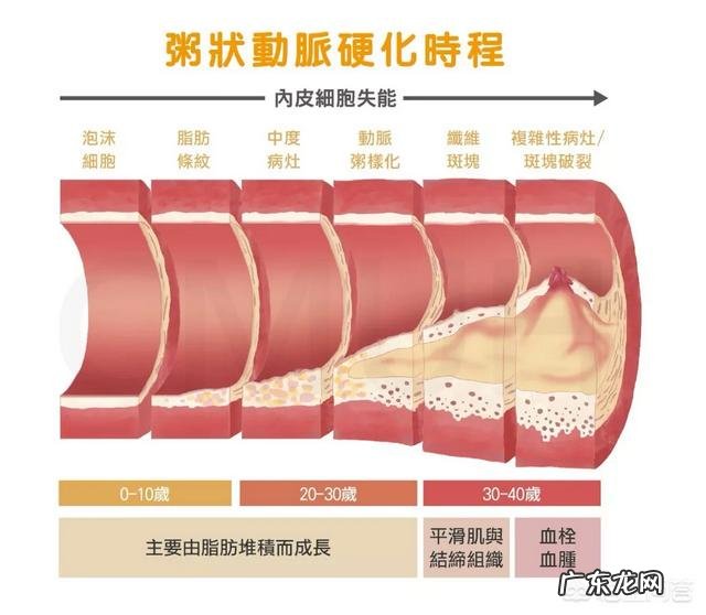 心脑血管吃什么品牌的鱼油好 吃鱼油类的保健品预防老年心脑血管疾病有效吗?