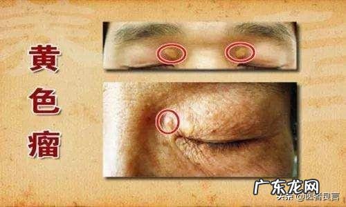 泡脚真的能zhi糖尿病吗？村里卖泡脚桶的老妇女发的？