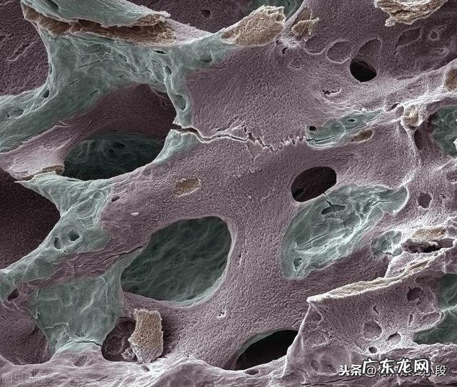 30岁如何增强骨密度 中年人如何增强自己的骨密度?