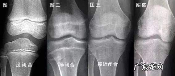 每天给孩子按摩,真的有助于长高吗