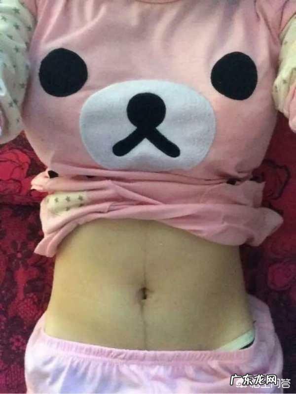 我产前145斤,生了宝宝之后10天瘦下来二十多斤,正常吗?