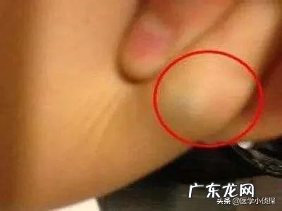 身体湿气重,用什么方法去除好?