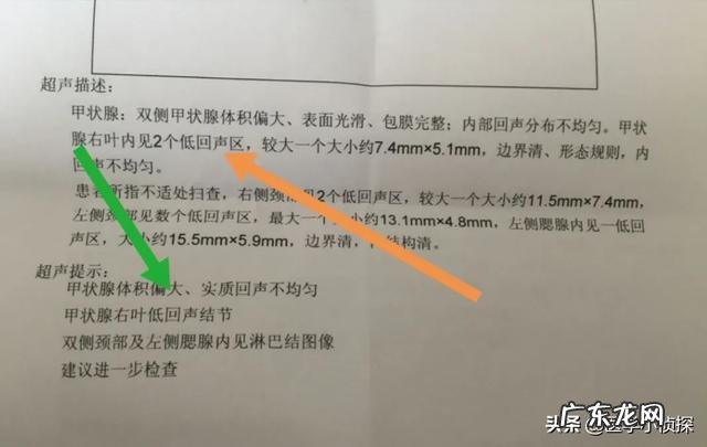 身体湿气重，用什么方法去除好？