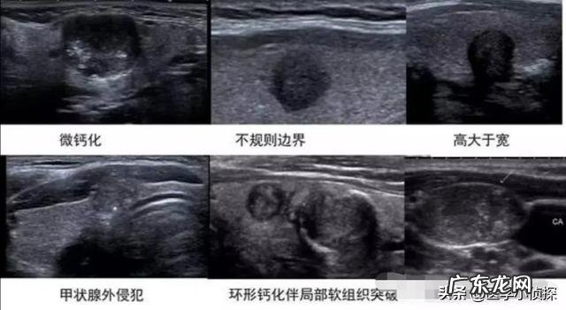 身体湿气重，用什么方法去除好？