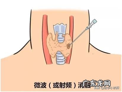 身体湿气重，用什么方法去除好？