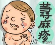 皮肤过敏荨麻疹能通过多运动锻炼增强免疫力改善吗