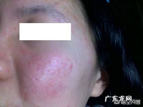 皮肤老化是怎么造成的呢?