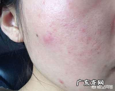 皮肤老化是怎么造成的呢?