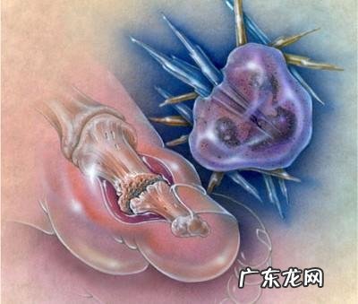 有痛风病友说,可以一边吃药一边吃肉,这是一种什么心理?