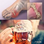 有痛风病友说，可以一边吃药一边吃肉，这是一种什么心理？