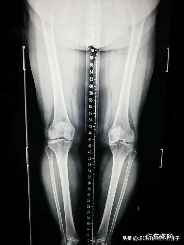 腿脚不利索,该如何保养膝盖关节