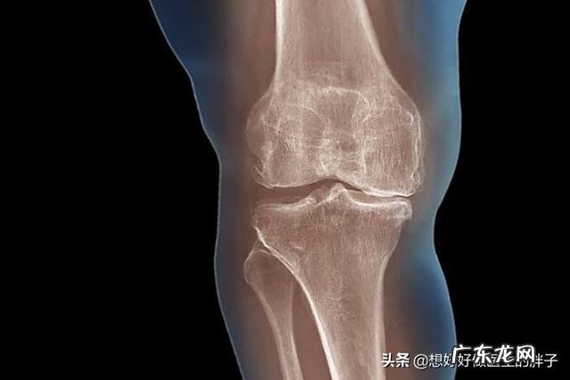 腿脚不利索,该如何保养膝盖关节