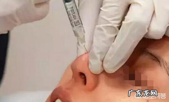 长期打玻尿酸会有后遗症吗?