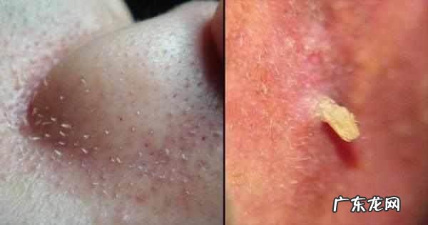 肝不好的人,会有哪些表现