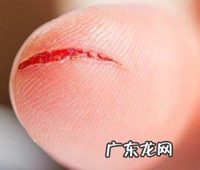 肝不好的人,会有哪些表现