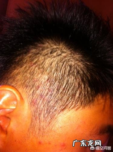 洗头掉下来的头发是本来就要掉的吗