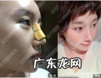 硅胶假体隆鼻失败后,要如何修复?